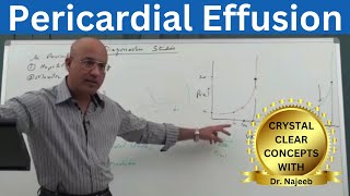 Pericardial Effusion  Pericardium  Cardiology🫀 [upl. by Ttezil]