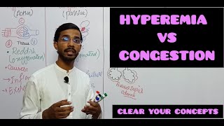 HYPEREMIA VS CONGESTION medicalpathologyhyperemiacongestion [upl. by Enilesor626]