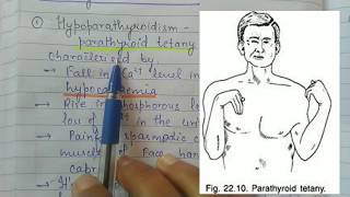 Parathyroid Disorders  Hypoparathyroidism and Hyperparathyroidism [upl. by Ecinrev]