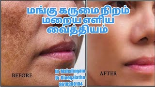 முகத்தில் வரும் மங்கு கருமை நிறம் நீங்கும் எளிய வைத்தியம்melasma blackneckdarkcirclepigmentation [upl. by Dunstan]