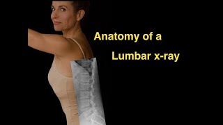 Anatomy of a Lumbar xray [upl. by Machute]