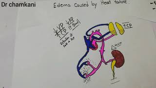 Renal system 25  How Edema occurs due to heart failure  Medical Physiology  Drchamkani [upl. by Cavanaugh852]