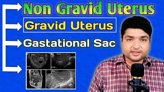 Gravid Uterus ka matlab kya hota hai  Gravid Uterus vs Non Gravid Ultrasound by Dr Ali Waqar [upl. by Xonel]