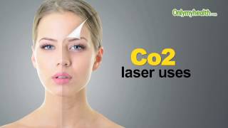 Co2 laser uses  Onlymyhealthcom [upl. by Eiger]