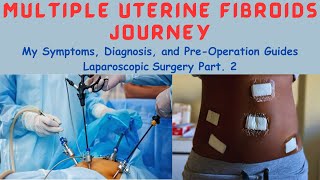 Multiple Uterine Fibroids Journey My Symptoms Diagnosis and PreOp Laparoscopic Myomectomy Part 2 [upl. by Parris]