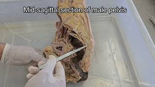 Mid sagittal section of Pelvis  Male and Female [upl. by Rausch861]