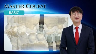 Master Course  BASIC ABT Level vs Implant Level Impression PART 2 [upl. by Leviram931]