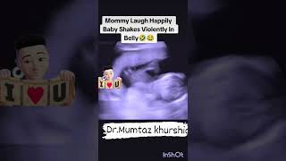 Pregnancy Ultrasound Scan [upl. by Yhtur]