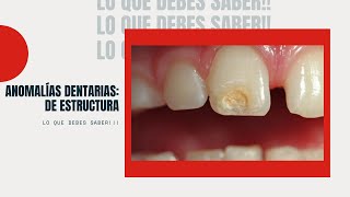 Anomalía DentariaDe estructura Hipoplasia del Esmalte Amelogénesis Imperfecta etc [upl. by Kristos]