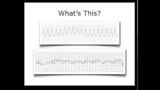 ECG Heart Rhythm Review [upl. by Mackoff]