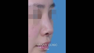 HanabiTV Nostril Show Correction [upl. by Nnyre]