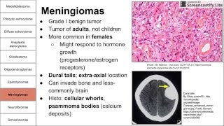 Nervous System Tumors [upl. by Aseeram217]