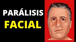 Parálisis facial síntomas diagnóstico tratamiento y pronóstico [upl. by Dinny631]