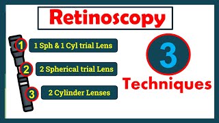 3 Techniques of Retinoscopy [upl. by Joacimah]