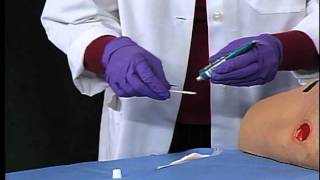 3M™ Tegaderm™ Hydrogel Wound Filler  Application and Removal [upl. by Eimareg]