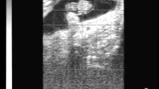 Bovine pregnancy 40 days with EasiScan ultrasoundwmv [upl. by Guenzi]