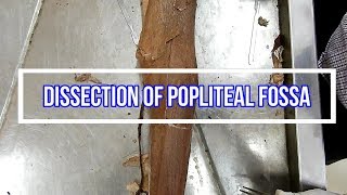 Dissection of Popliteal Fossa [upl. by Adhamh]