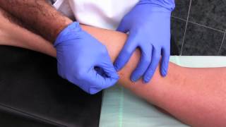 Punción seca del músculo gemelo interno Dry needling [upl. by Oderfigis180]