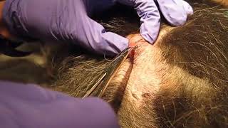 Cuterebra Removal [upl. by Cristi]