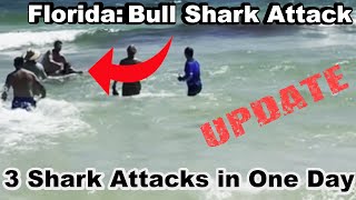 Update 3 Florida Shark Attacks in 1 Day Teen Loses Arm amp Leg to Shark Lulu GribbinElisabeth Foley [upl. by Seitz]