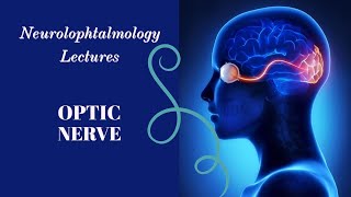 NEUROOPHTALMOLOGY lecture 2 OPTIC DISC EDEMA [upl. by Nyla]