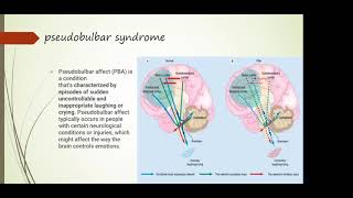 19 Bulbar and pseudobulbar syndrome topical and differential diagnostics [upl. by Roskes]