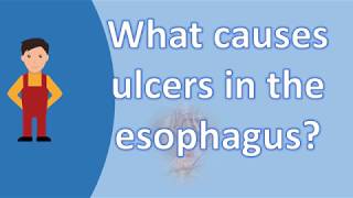 What causes ulcers in the esophagus   BEST Health FAQs [upl. by Lemrahs]