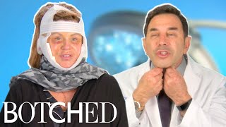 Dr Nassif Fixes Lisa’s Facelift Gone Wrong FULL TRANSFORMATION  Botched  E [upl. by Mcbride]