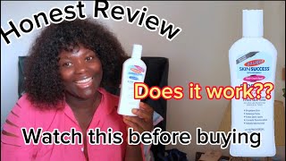 PALMER’S SKIN SUCCESS FADE MILK HONEST REVIEW  WATCH THIS BEFORE BUYING [upl. by Yennek]