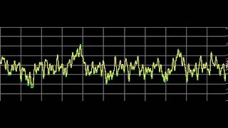 Candidiasis Candida Albicans  Rife Frequencies [upl. by Maidie]