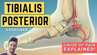 Tibialis Posterior Exercises Treat the Root Cause of Your Tib Post Pain PTTD [upl. by Tirza]