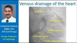 Venous drainage of the heart [upl. by Lipson]