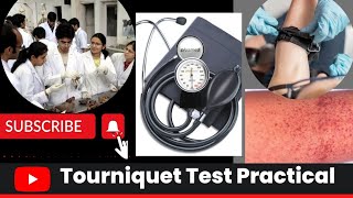 What is Tourniquet test  टूर्निकेट टेस्ट  Clotting Disorder test  medical viral practical [upl. by Roos786]