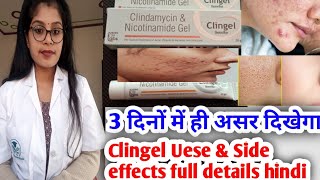 Clingel gel  Clindamycin amp Nicotinamide gel  Clingel review Clingel uese amp Side effects in hindi [upl. by Don418]