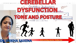 Cerebellar Dysfunctions Tone and posture and equilibrium [upl. by Teri114]