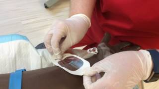 IV Insertion and Discontinue Procedure [upl. by Radbourne]