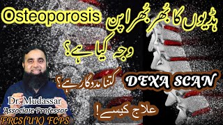 Understand Osteoporosis with Accurate information  Causes Diagnosis amp Treatment [upl. by Sybyl161]