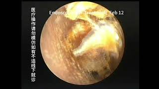 Differences in 3 types of ear conditions [upl. by Ahsinut471]