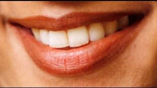 How to Whiten Your Teeth with a Home Remedy  Episode 6 [upl. by Leah137]