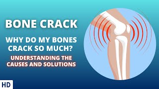 Bone Crack The Science Behind the Popping Sounds [upl. by Hyrup299]