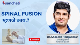 Spinal Fusion म्हणजे काय  Dr Shailesh Hadgaonkar  Spine Expert at Sancheti Hospital  Pune [upl. by Ferino691]