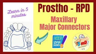 RPD  MAXILLARY MAJOR CONNECTORS  Prosthodontics  easy notes [upl. by Nita]