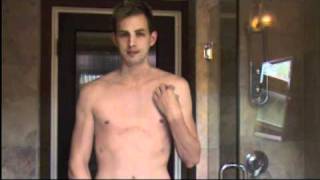 Day 200 65 Months  Pectus Excavatum Ravitch  Incredible results [upl. by Ahsel368]